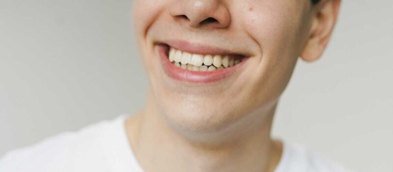 Çene Tedavisi Ne Kadar Sürer?