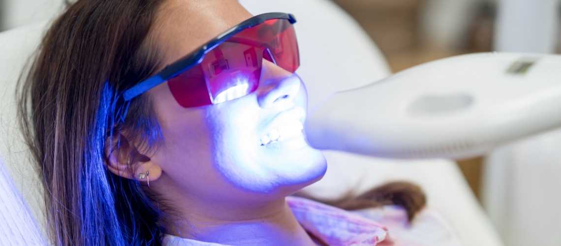 Diş Beyazlatma Fiyatları