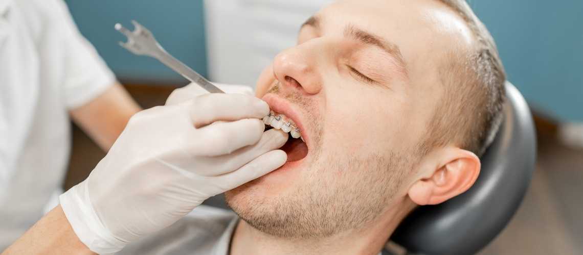 Fonksiyonel Ortodontik Tedavi Fiyatları