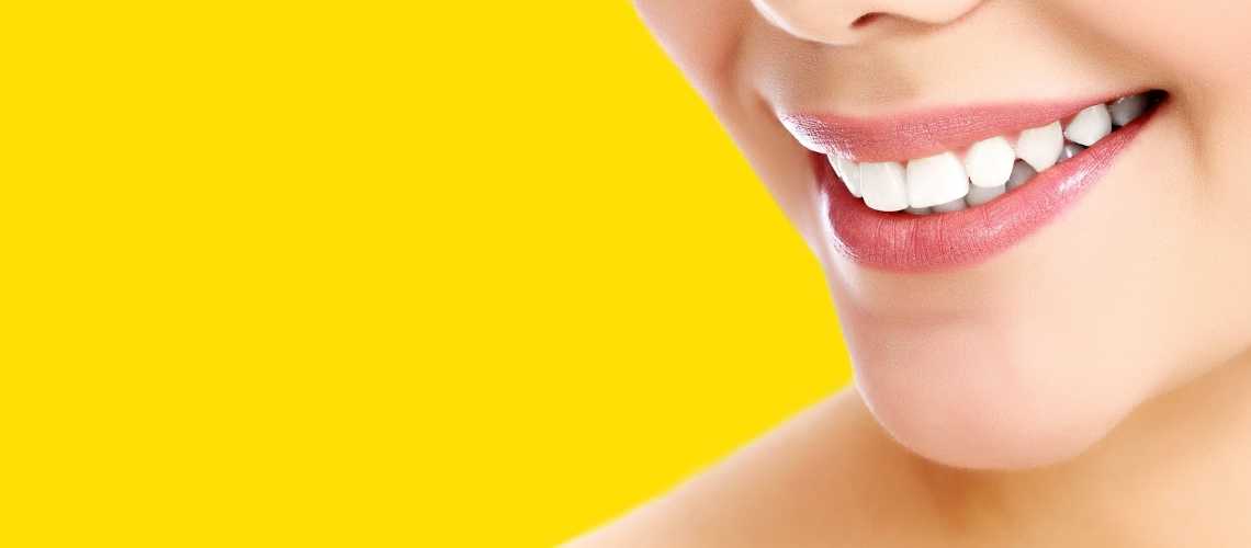 Gülüş Estetiği Fiyatları