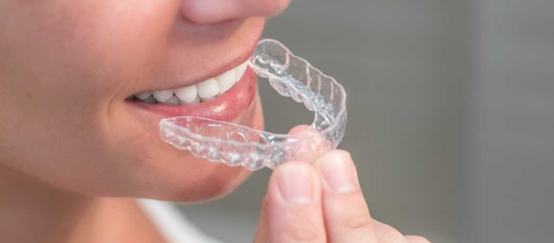 Şeffaf Plak Tedavisi Fiyatları